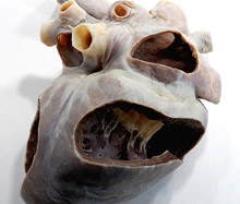 Heart anatomy specimen